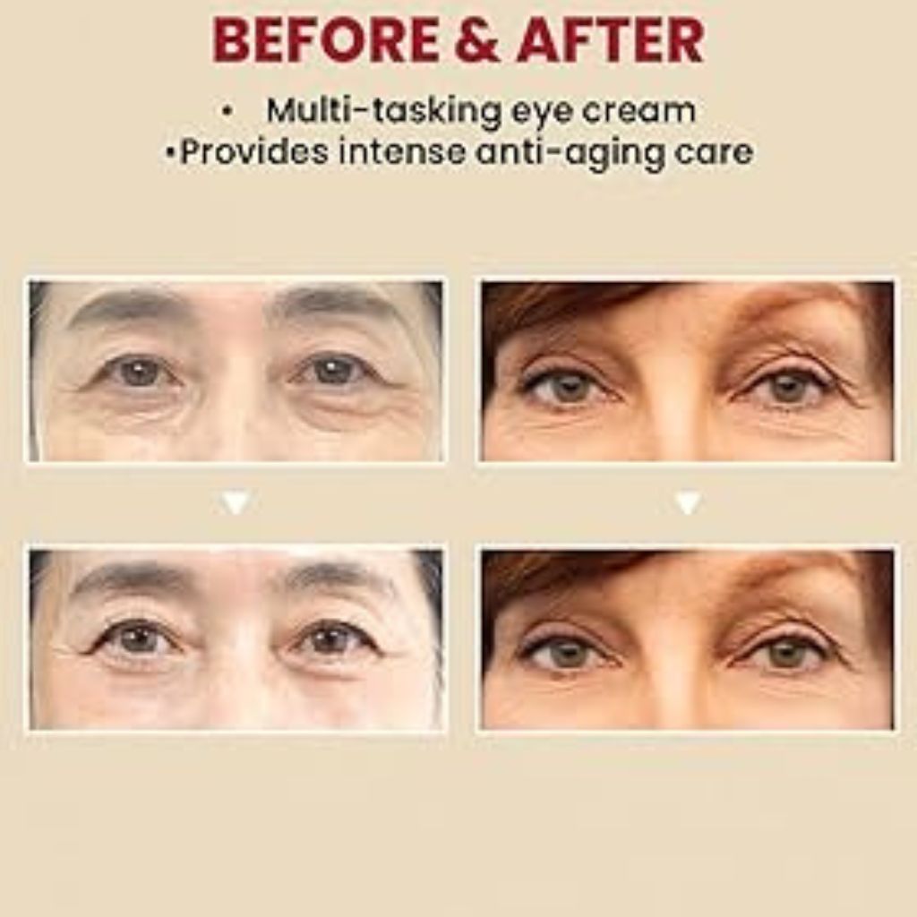KSECRET - SEOUL 1988 Eye Cream: Retinal Liposome 4 Percent + Fermented Bean 30ml