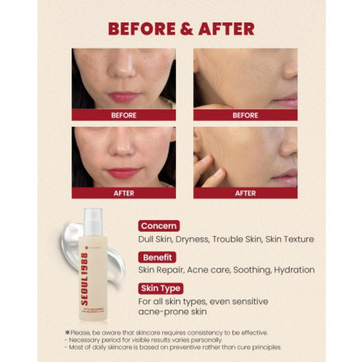 KSECRET - SEOUL 1988 Essence: Snail Mucin 97 Percent + Rice 100ml