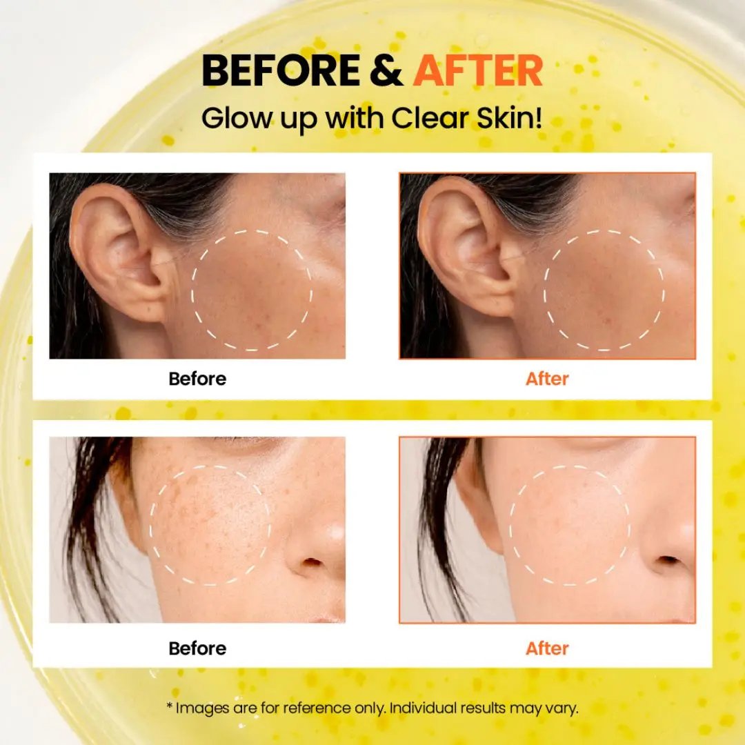 K-Secret - SEOUL 1988 GLOW SERUM : NIACINAMIDE 15% + YUJA K-Secret