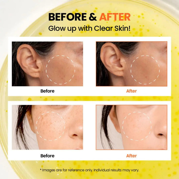 K-Secret - SEOUL 1988 GLOW SERUM : NIACINAMIDE 15% + YUJA K-Secret