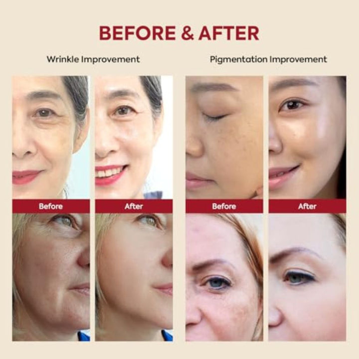 KSECRET - SEOUL 1988 Serum: Retinal Liposome 2 Percent + Black Ginseng 30ml