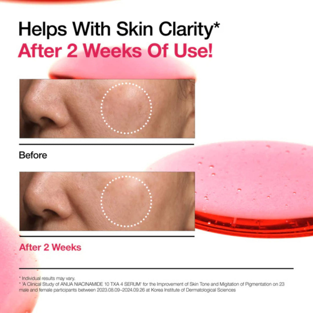 Anua Niacinamide 10 + TXA 4 Serum