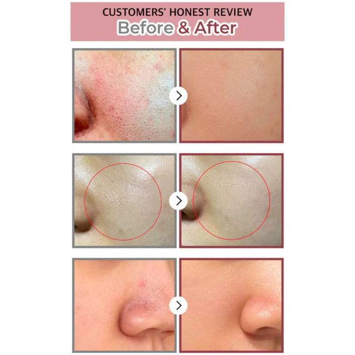 Numbuzin No.3 Tingle-Pore Softening Sheet Mask 4ea