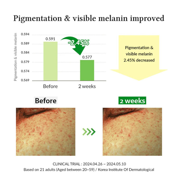 Dr. Althea – Gentle Vitamin C Serum 30ml