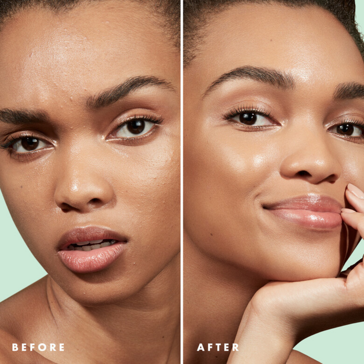e.l.f. Blemish Control Primer – Acne-Fighting Makeup Primer (14ml)
