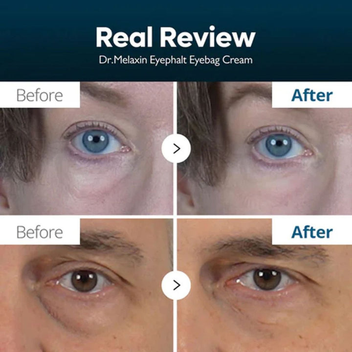 Dr. Melaxin - Eyephalt Eye Cream for Eyebags 10ml