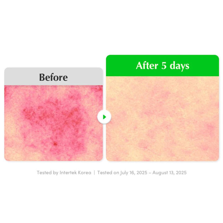 EQQUALBERRY - ALOE PDRN CALMING SERUM 30ML