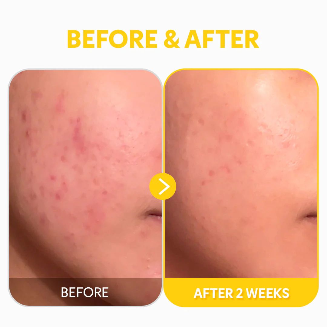 TIRTIR Pure Vitamin C24 Serum 30ml