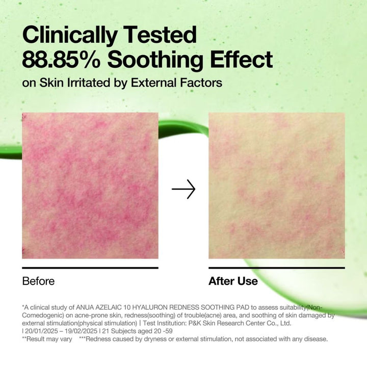 Anua - Azelaic 10 Hyaluron Redness Soothing Pad (90 Pads, 230ml)