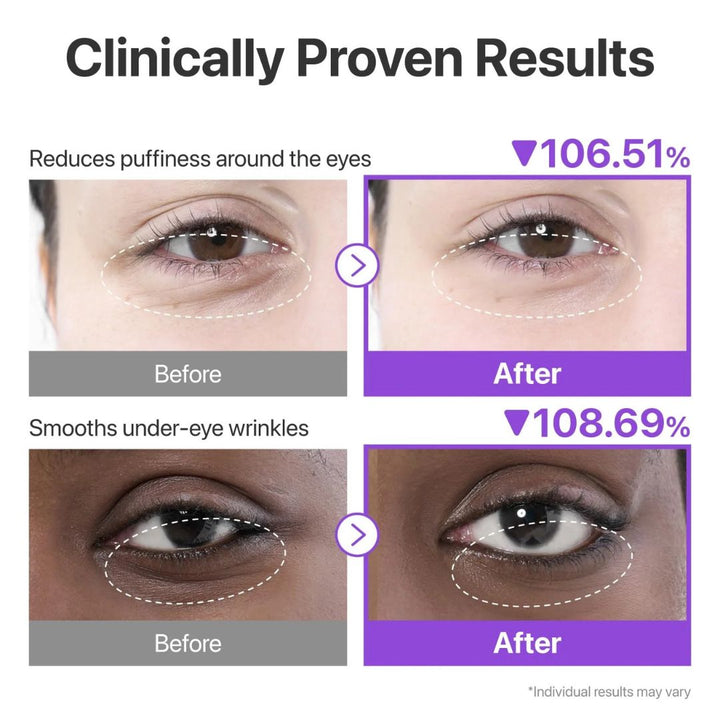 NUMBUZIN - No.9 NAD+ Collagen Under Eye Patches 5ea