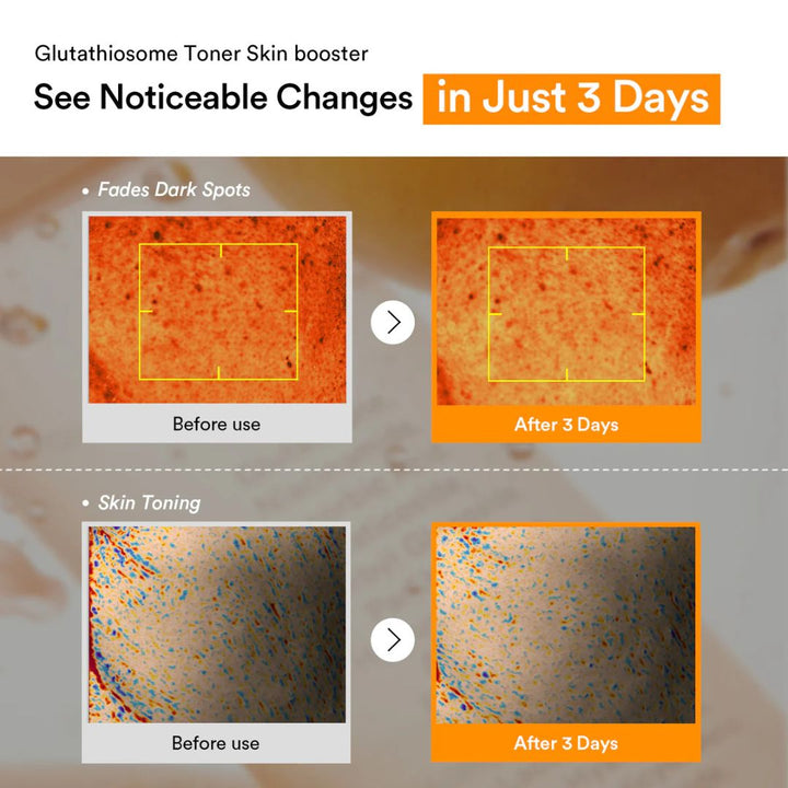 Abib - Glutathiosome Dark Spot Toner Skin booster