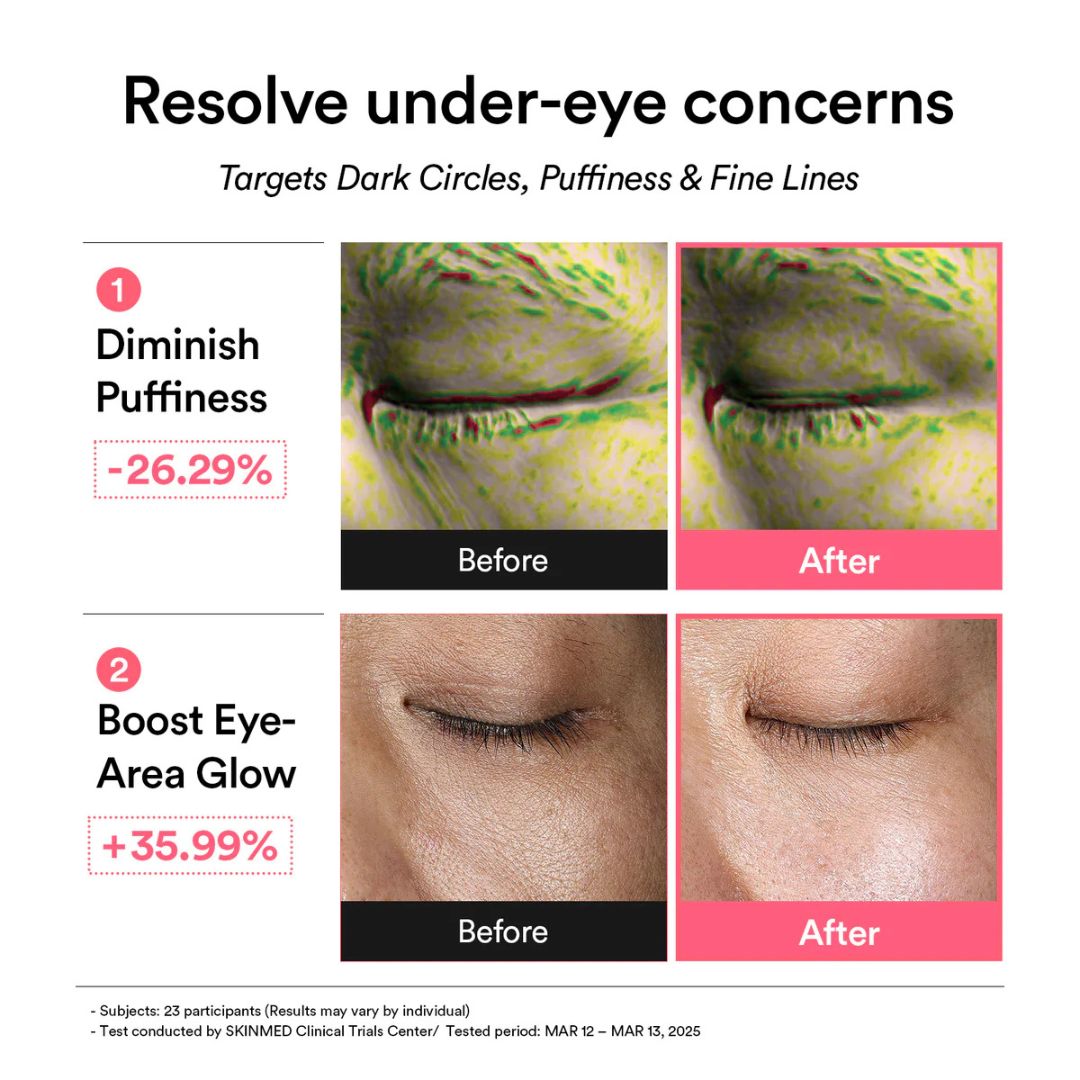 Abib - PDRN Retinal Eye Patch Glow Jelly (60ea)