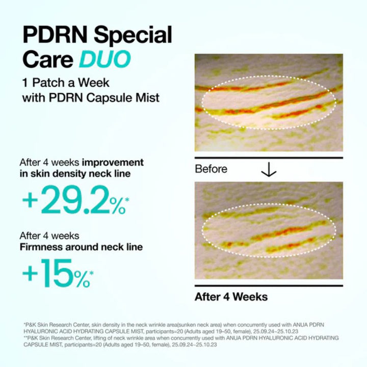 Anua - PDRN Collagen Melting Patch For Neck 4ea