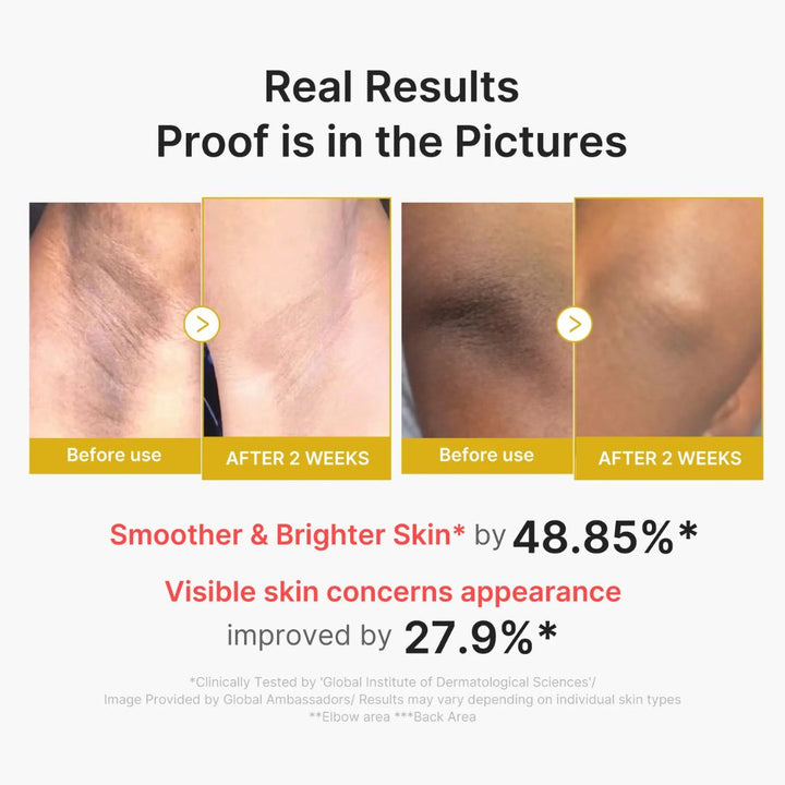 Medicube - Kojic Acid Turmeric Body Peel Shot