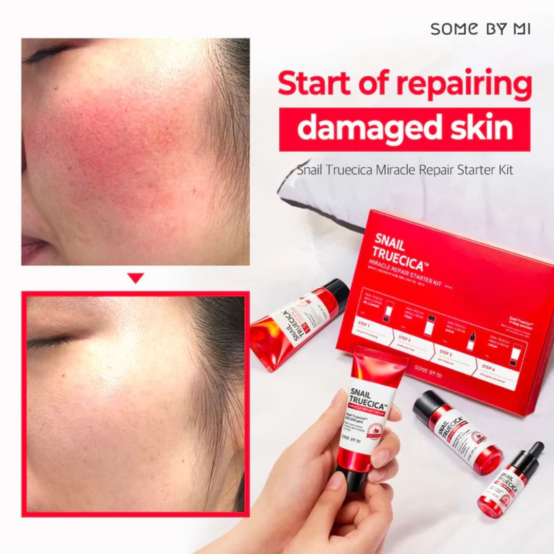 Some By Mi - Snail Truecica Miracle Repair Starter Kit